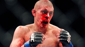 Joe Lauzon